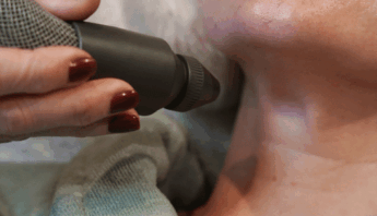 La cryothérapie pour les femmes