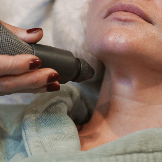 La cryothérapie pour les femmes